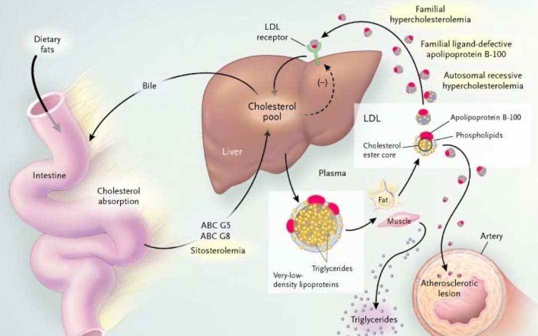 Cholesterol 101: Making Sense of LDL, HDL, Triglycerides, and Beyond