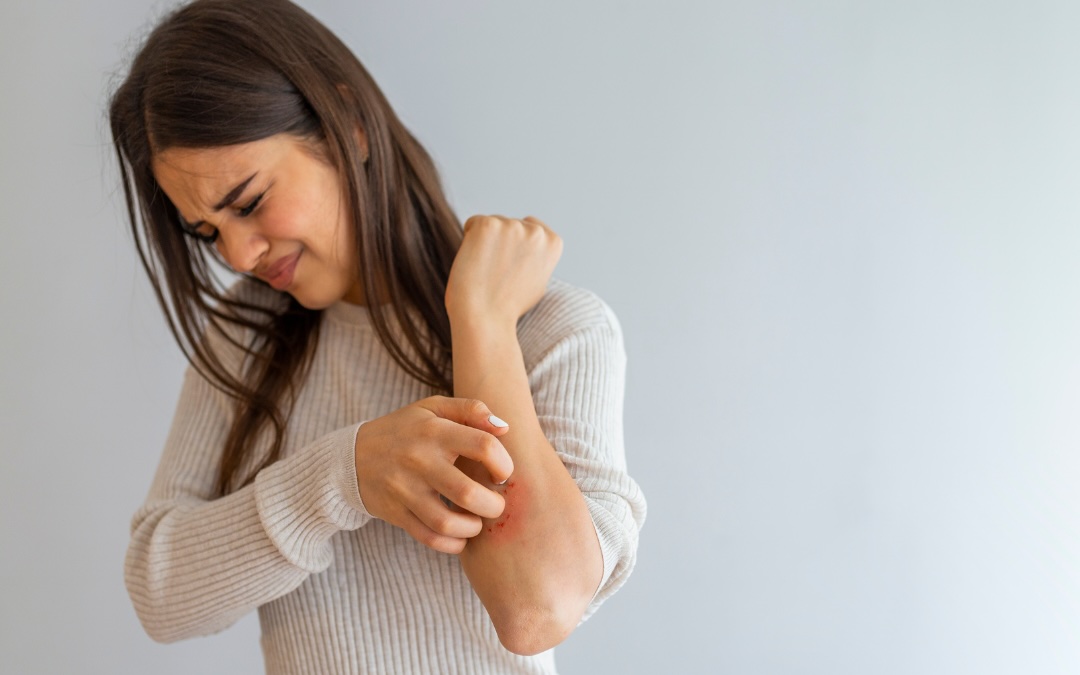 Psoriasis vs Eczema